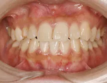 見た目はキレイな口