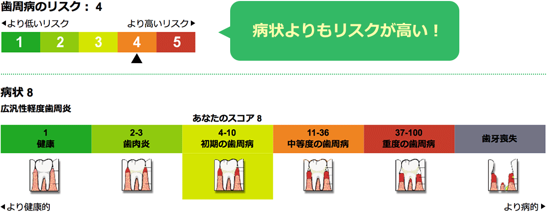 グラフ